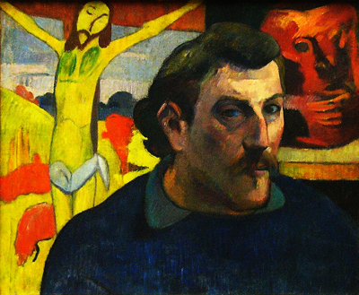 Posthumous Prognosis for Supposedly Syphilitic Gauguin, via His Teeth